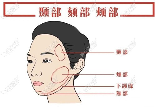 颏成型手术和正颌的区别可从效果和风险两方面分析