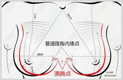 沸腾丰胸优势