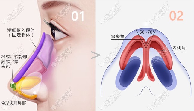 国内有名的鼻修复医生排名前十做鼻修复技术特色