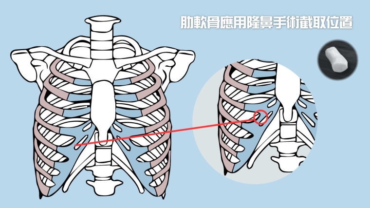 今日解答昆明做鼻中隔手术费用需要多少