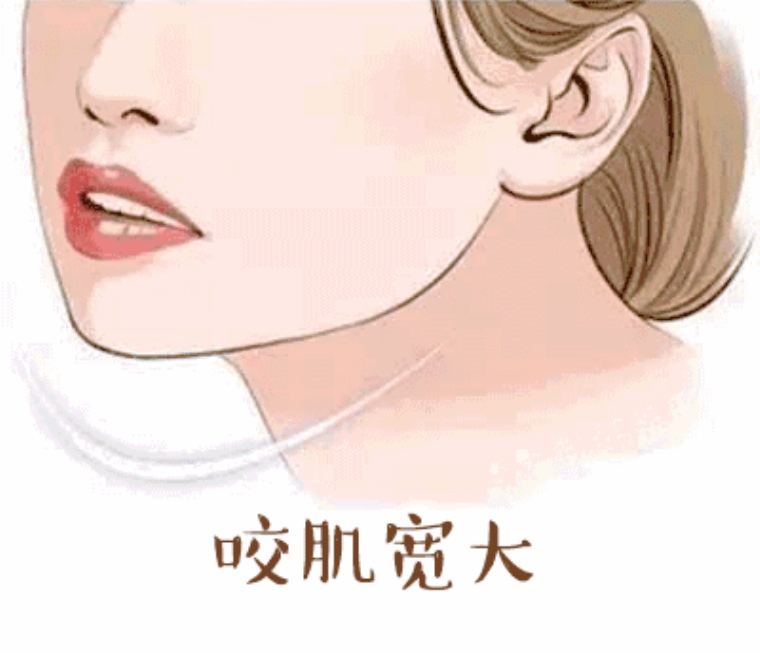 美容师说说瘦脸针有什么副作用