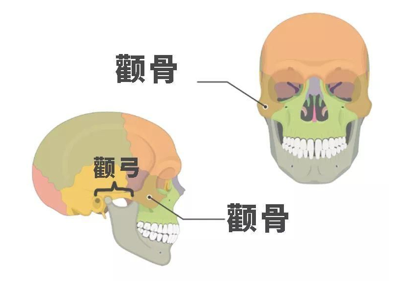 颧骨高怎么办